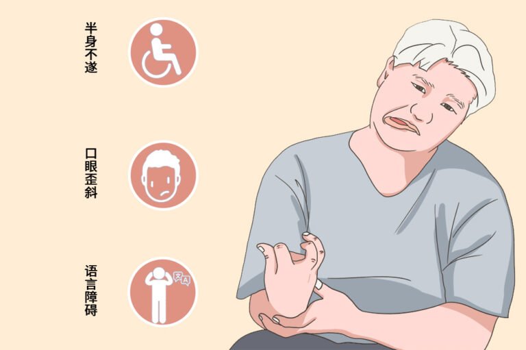 惊悚!你是否忽视了中风的前兆?生命就在一瞬间!