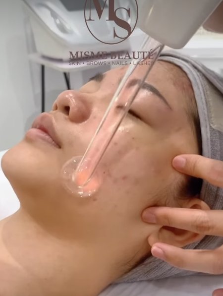 马来西亚敏感肌美容院